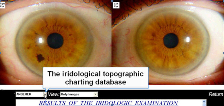 Iridology Chart Software