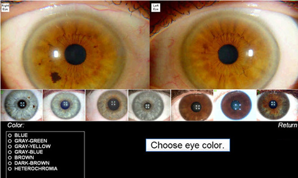 Iridology Chart Software