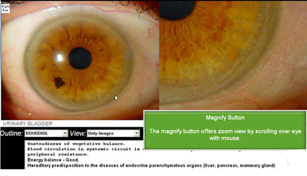 Magnify